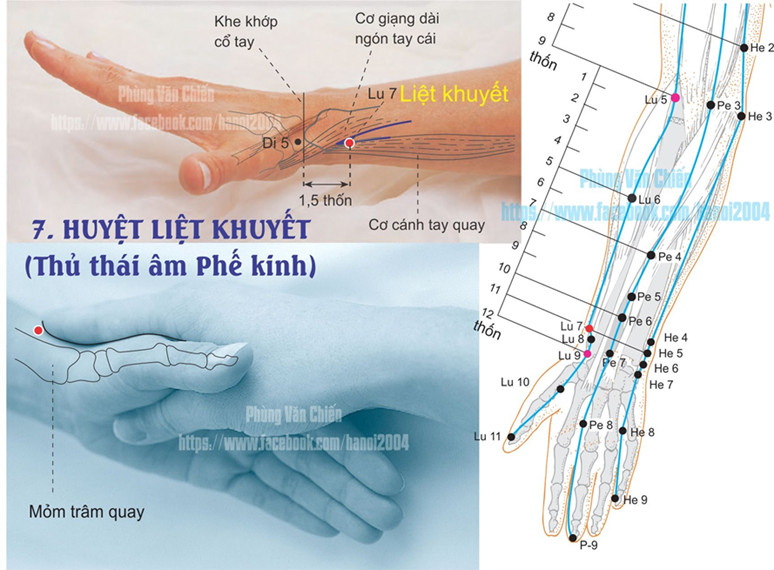 1.7. LIỆT KHUYẾT