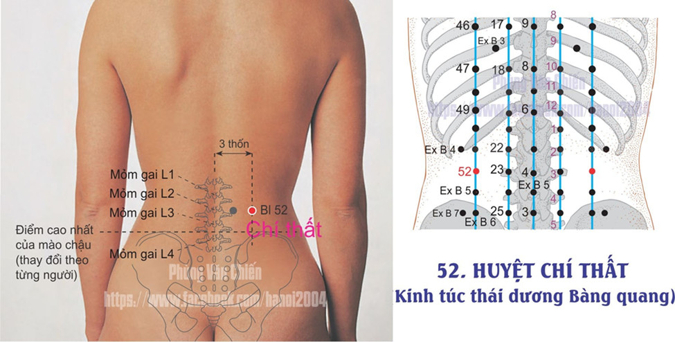 7.47. CHÍ THẤT