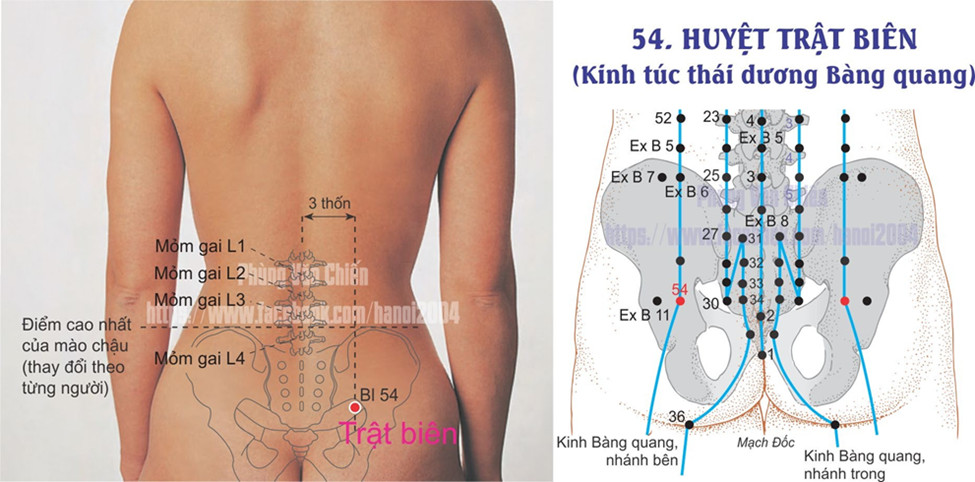 7.49. TRẬT BIÊN