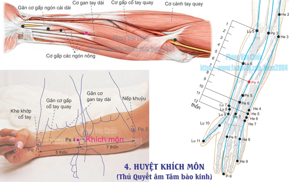 9.4. KHÍCH MÔN