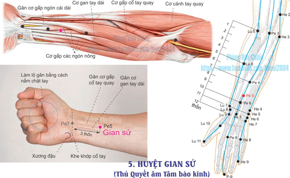 9.5. GIẢN SỬ