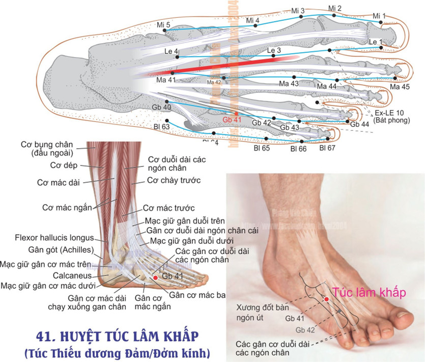 11.41. TÚC LÂM KHẤP