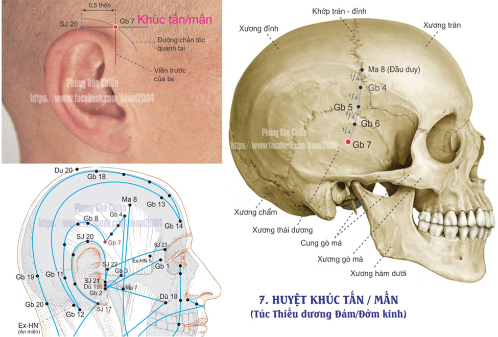 11.7. KHÚC PHÁT