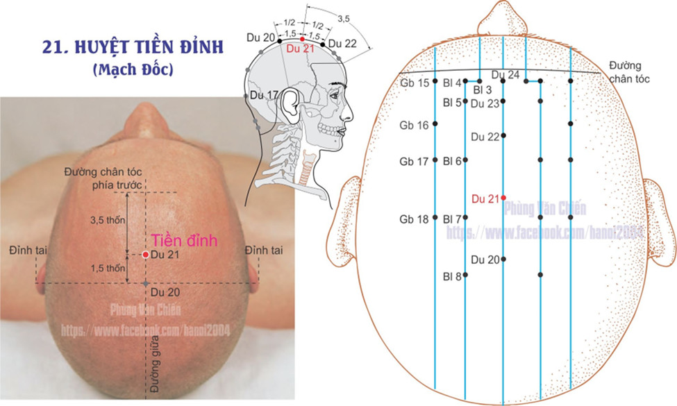 14.21. TIỀN ĐÌNH