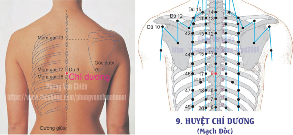 14.9. CHÍ DƯƠNG