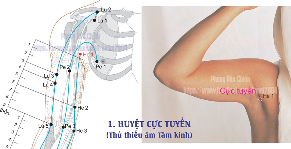 5.1. CỰC TUYỀN