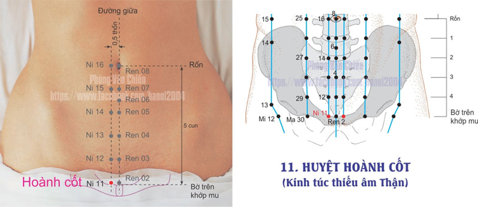 8.11. HOÀNH CỐT