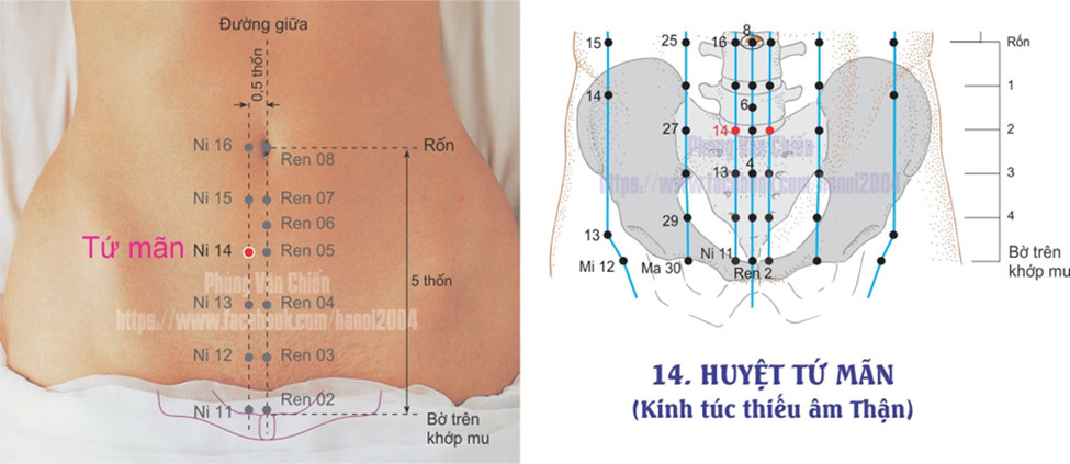 8.14. TỨ MÃN