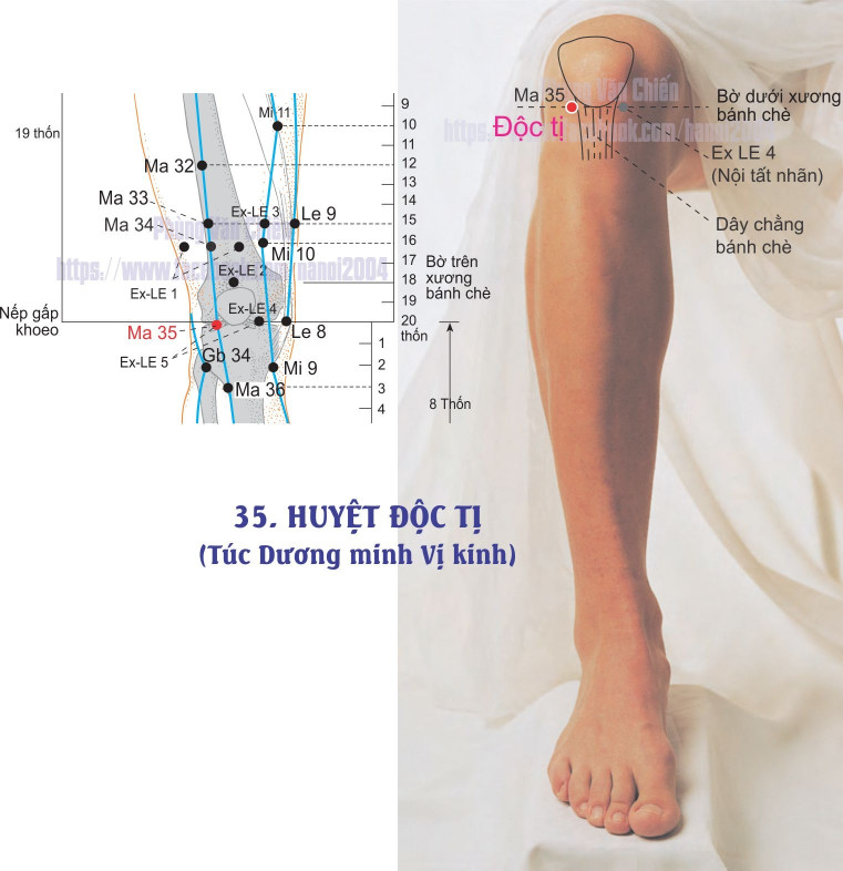 3.35. ĐỘC TỴ