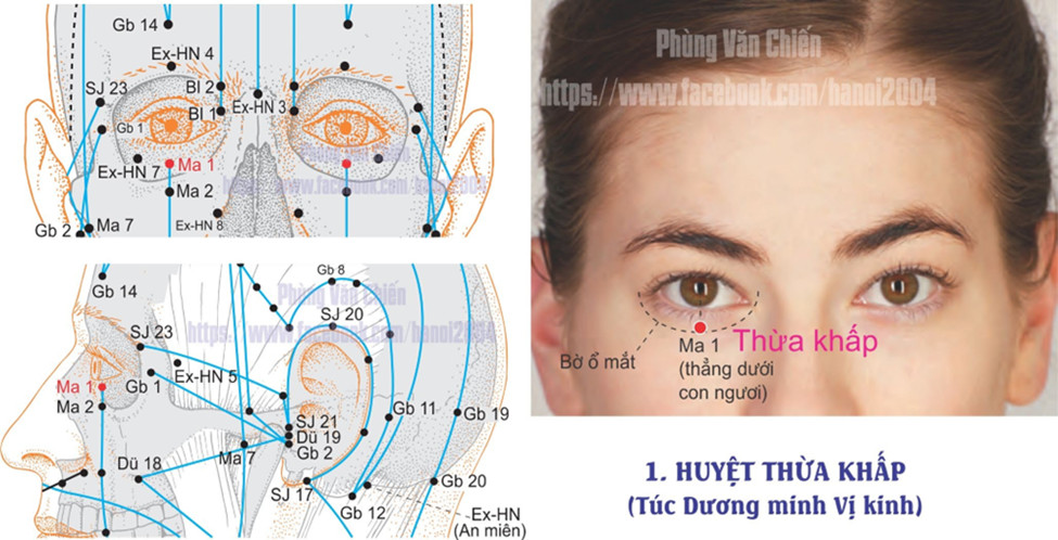 3.4. THỪA KHẤP