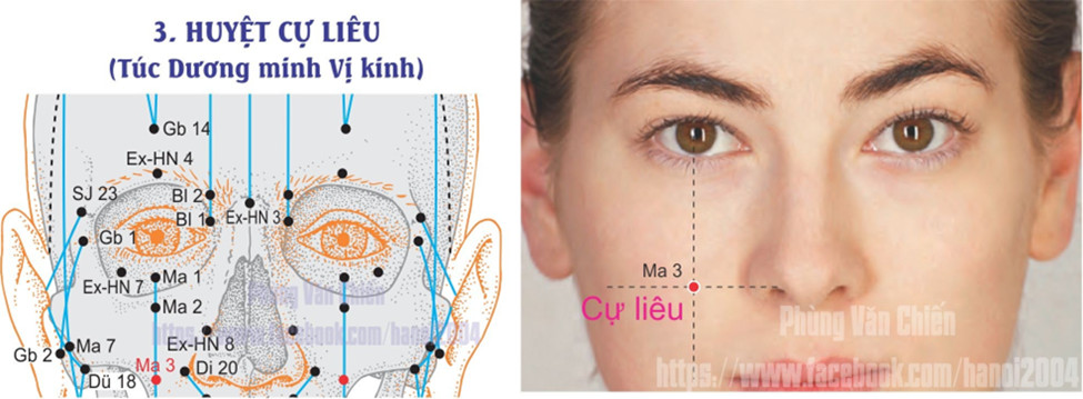 3.6. CỰ LIÊU