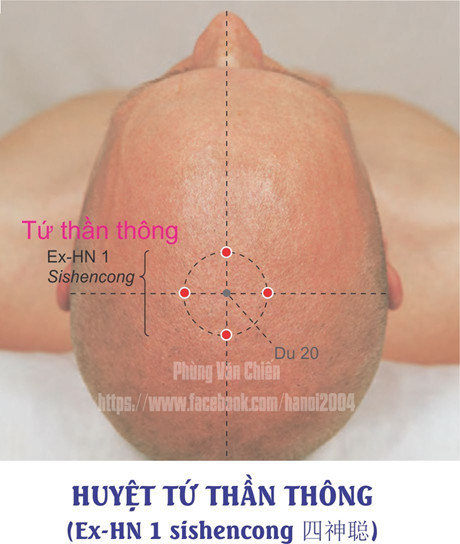 1.1. TỨ THẦN THÔNG