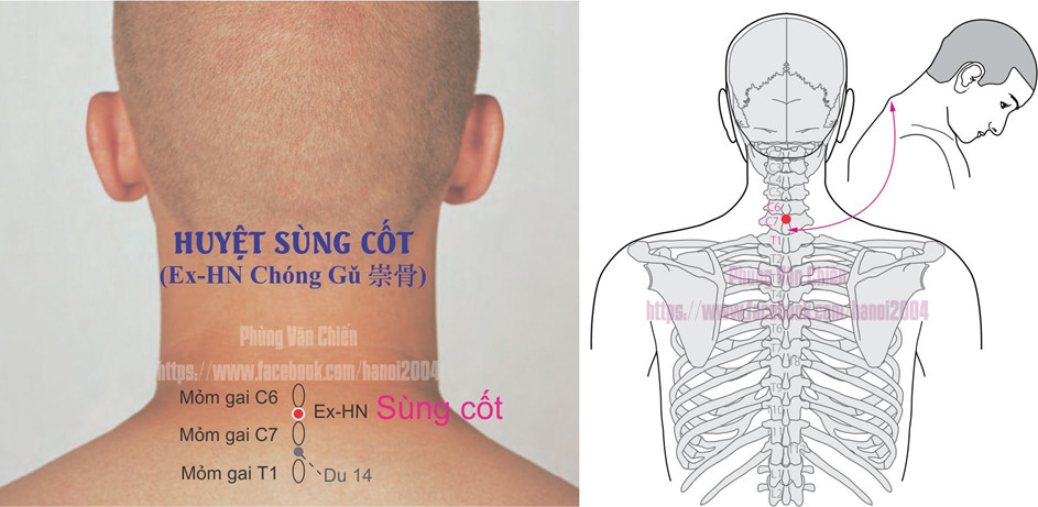 1.20. SÙNG CỐT