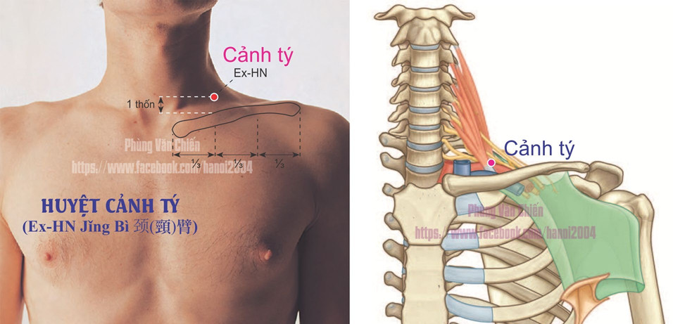 1.21. CẢNH TÝ