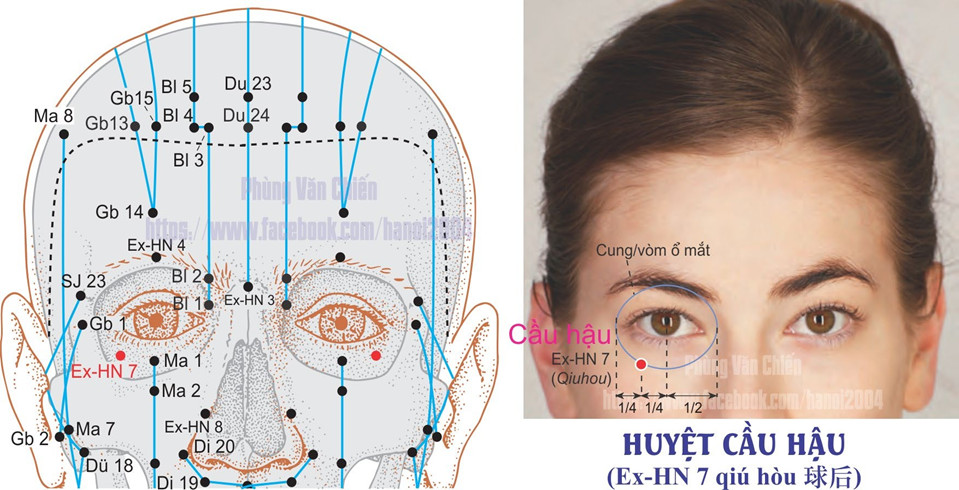 1.7. CẦU HẬU