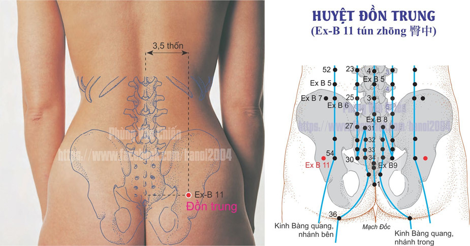 3.11. ĐỒN TRUNG