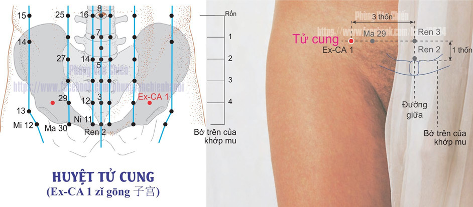 2.1. TỬ CUNG