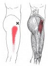 CƠ CĂNG MẠC ĐÙI (Tensor Fasciae Latae)