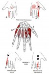 CƠ DẠNG NGÓN TAY ÚT (Abductor Digiti Minimi)