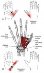 CƠ ĐỐI NGÓN CÁI (Opponens Pollicis)