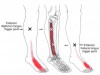 CƠ DUỖI DÀI CÁC NGÓN CHÂN (Extensor Digitorum Longus)