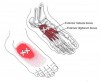 CƠ DUỖI NGẮN NGÓN CHÂN CÁI (Extensor Hallucis Brevis)