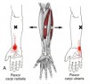 CƠ GẤP CỔ TAY QUAY (Flexor Carpi Radialis)