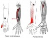 CƠ GẤP NGÓN CÁI DÀI (Flexor Pollicis Longus)