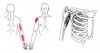 CƠ QUẠ CÁNH TAY (Coracobrachialis)