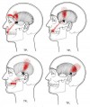 CƠ THÁI DƯƠNG (Temporalis)