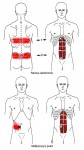 CƠ THẮNG BỤNG (rectus abdominus)